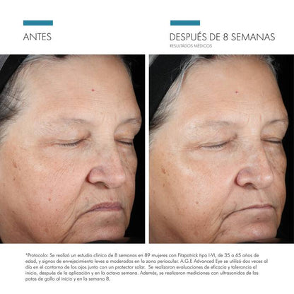 Contorno de Ojos Antiedad A.G.E. Eye Complex SkinCeuticals | 15 ml